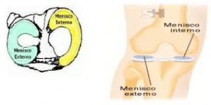 menisc